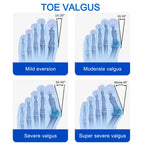 Bunion Splint Big Toe Straightener Hallux Valgus Correction Orthotics Foot Bone Thumb Adjuster Correction Bunions Corrector